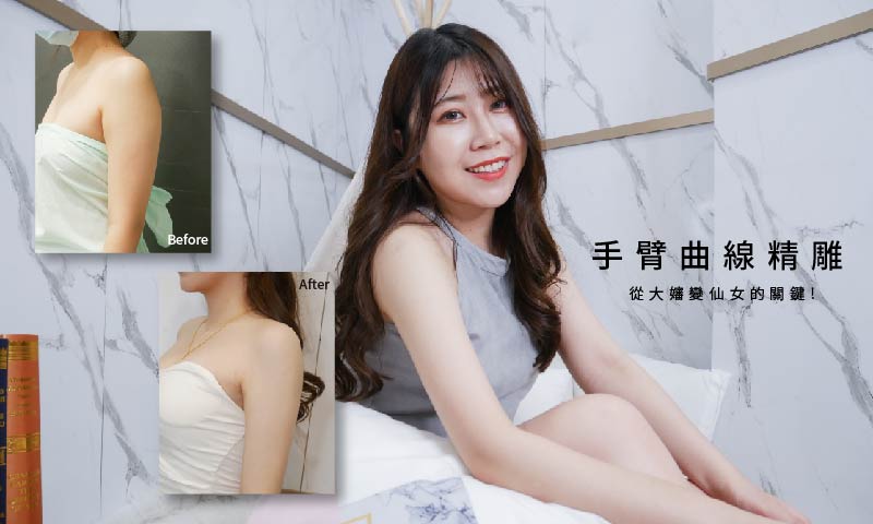 Read more about the article 胸大女孩的困擾~手臂精雕術~打造你的夢幻曲線