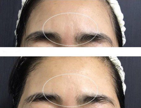 LINE_ALBUM_Liftera2行銷素材_260115_1