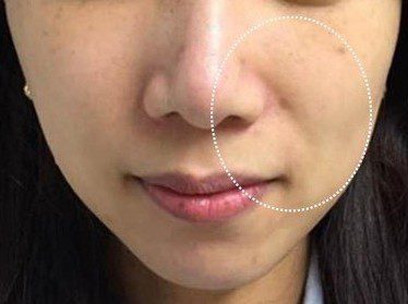 LINE_ALBUM_Liftera2行銷素材_260115_3