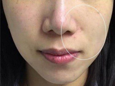 LINE_ALBUM_Liftera2行銷素材_260115_32