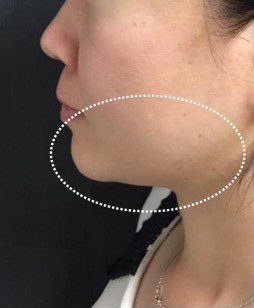 LINE_ALBUM_Liftera2行銷素材_260115_4