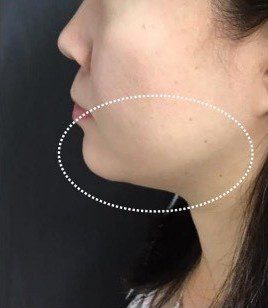 LINE_ALBUM_Liftera2行銷素材_260115_42