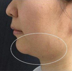 LINE_ALBUM_Liftera2行銷素材_260115_5