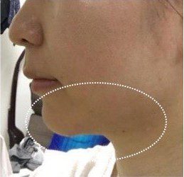 LINE_ALBUM_Liftera2行銷素材_260115_52