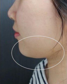 LINE_ALBUM_Liftera2行銷素材_260115_6