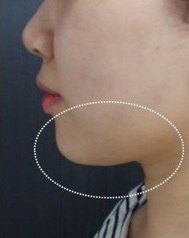 LINE_ALBUM_Liftera2行銷素材_260115_62