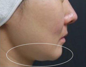 LINE_ALBUM_Liftera2行銷素材_260115_7